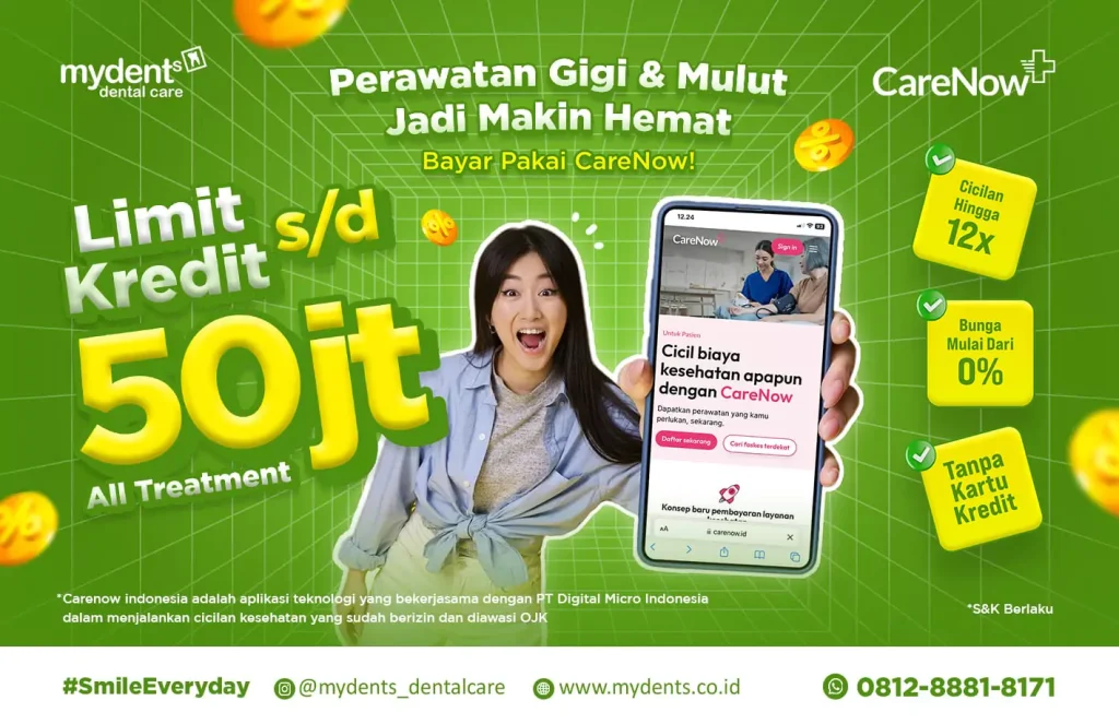 Promo Cicilan Perawatan Gigi dengan Carenow 2025