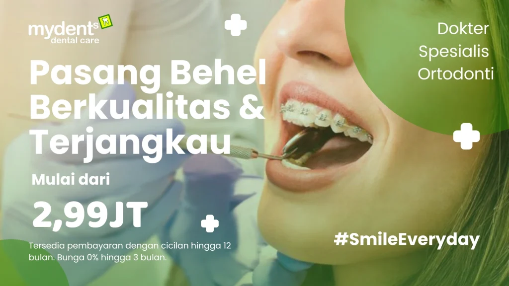promo pasang behel gigi metal berkualitas