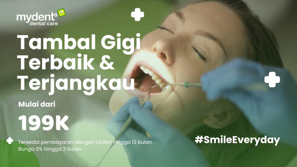 promo tambal gigi depan dan tambal gigi berlubang