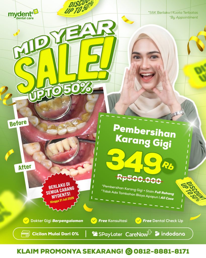 promo_mid-year-sale_scaling-gigi