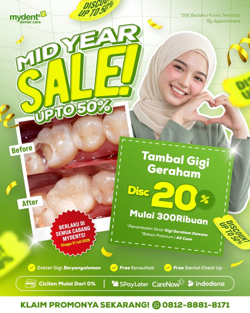 promo_mid-year-sale_tambal-gigi