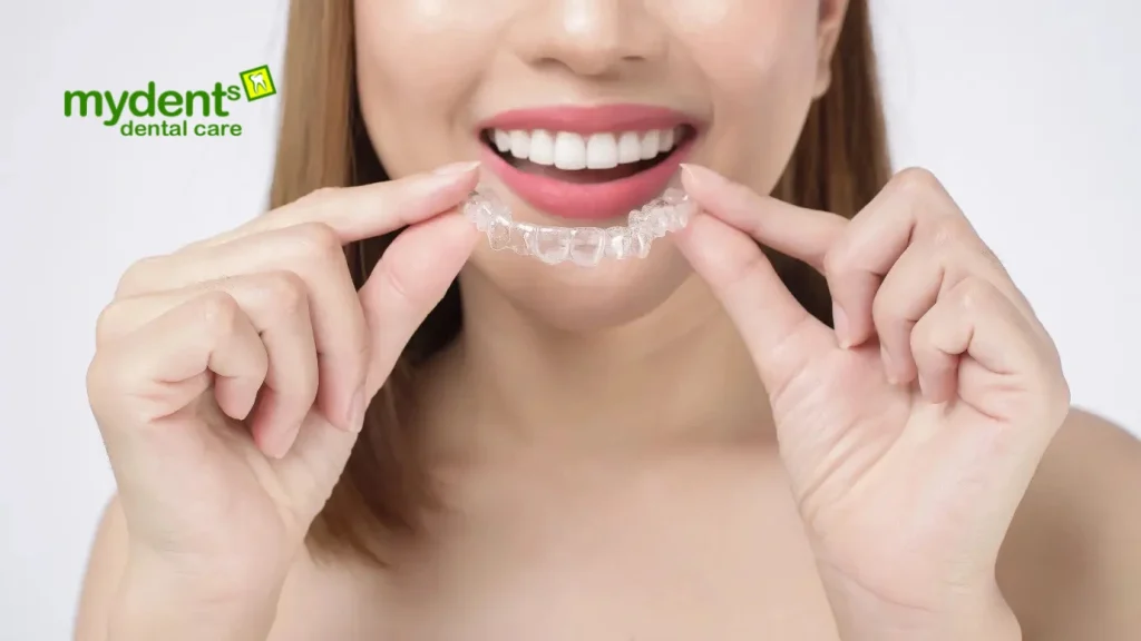 aligner-gigi-adalah