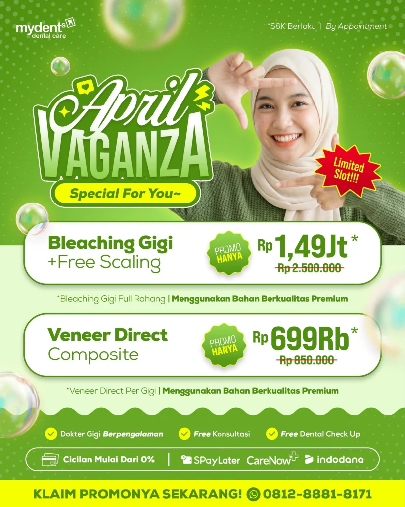 promo-bleaching-veneer-mydents