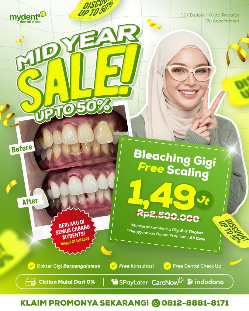 promo_mid-year-sale_Bleaching-gigi