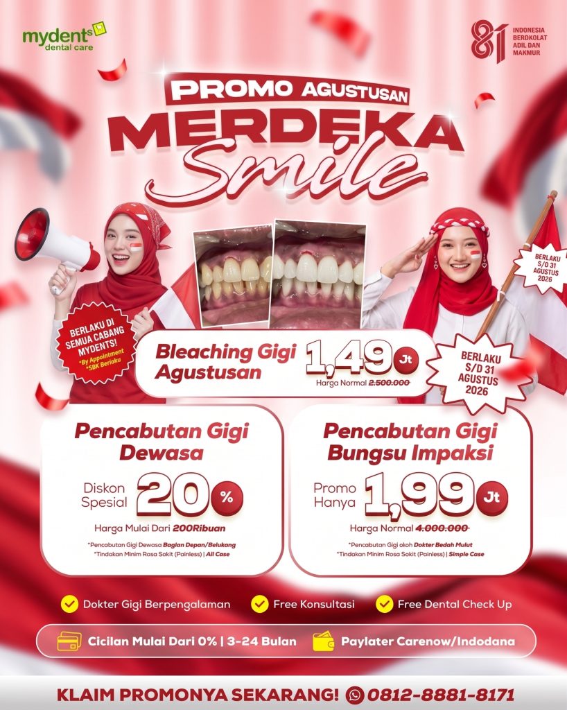 PROMO-AGUSTUSAN-MERDEKA-SMILE-MYDENTS-PROMO-BLEACHING-CABUT-GIGI-ODONTEKTOMI