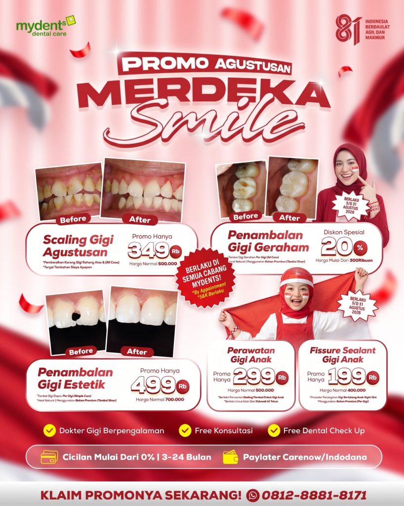 PROMO-MERDEKA-SMILE-MYDENTS-PROMO-PERAWATAN-DASAR