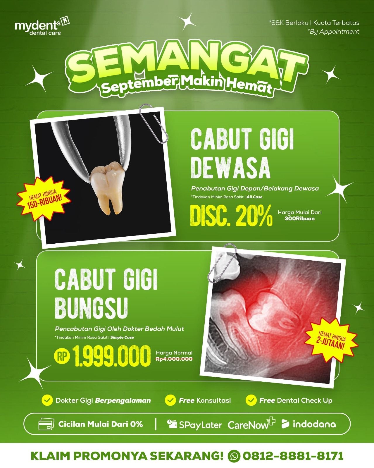 promo cabut gigi geraham dan cabut gigi bungsu terbaru september mydents