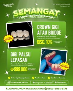 promo gigi palsu terbaru september mydents