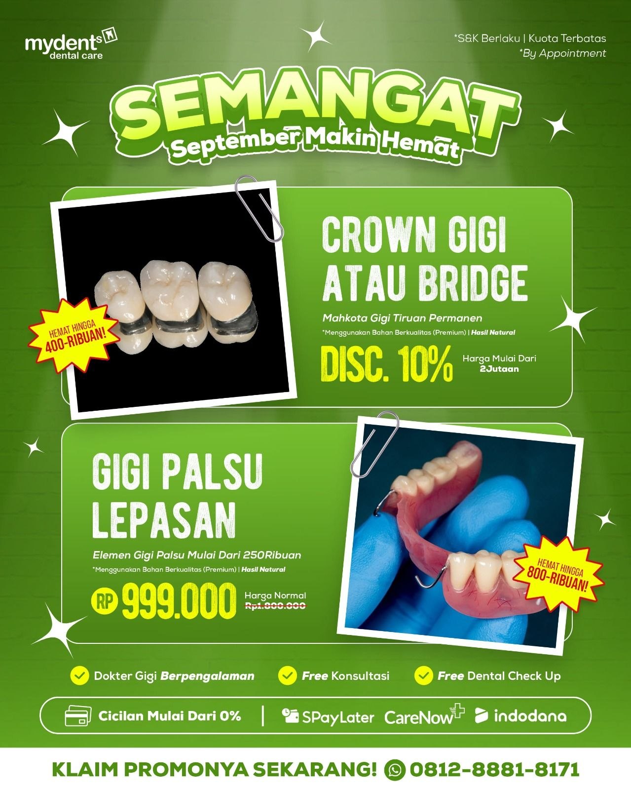 promo gigi palsu terbaru september mydents