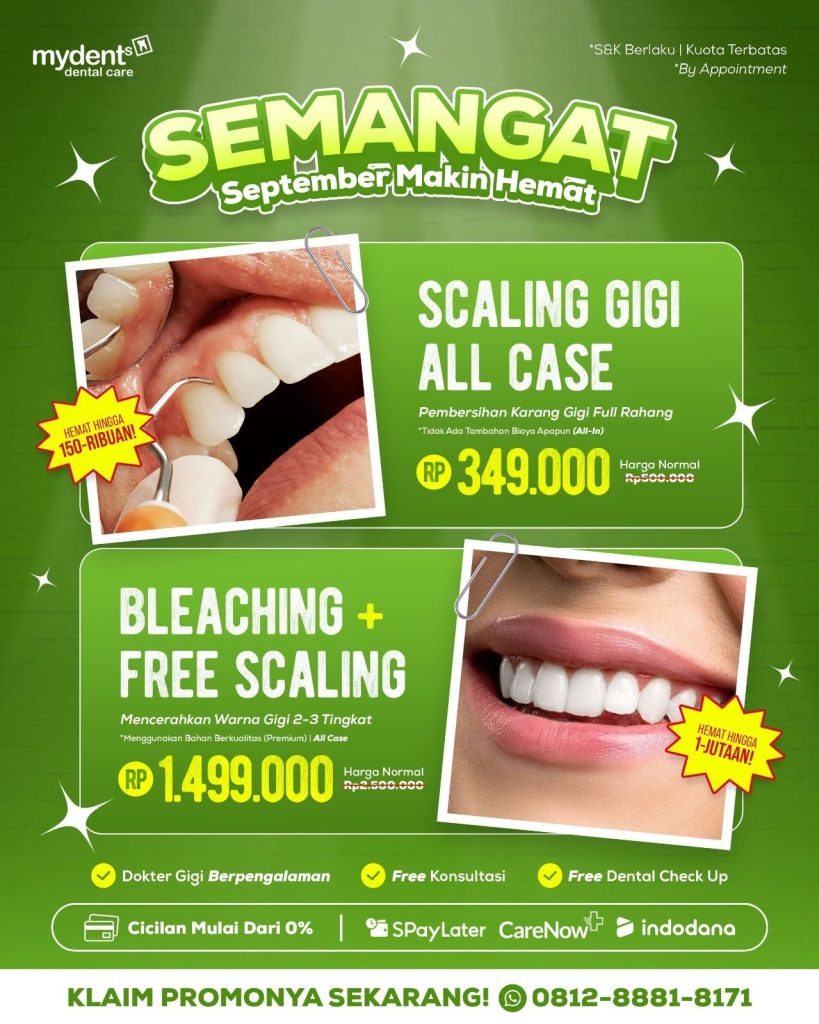 promo scaling bleaching september terbaru mydents