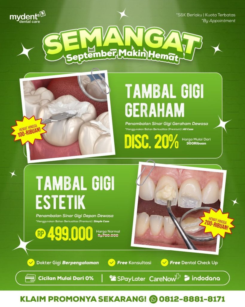 promo tambal gigi terbaru september 2026 mydents
