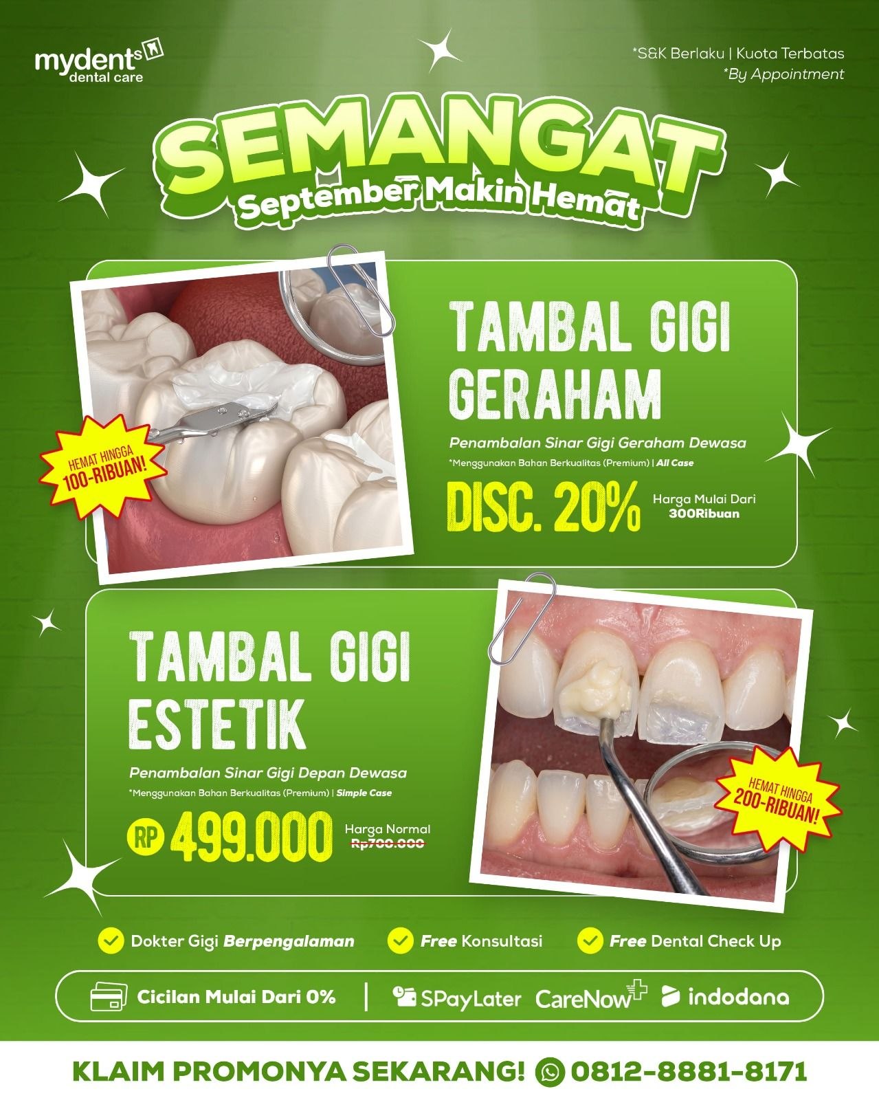 promo tambal gigi terbaru september 2026 mydents